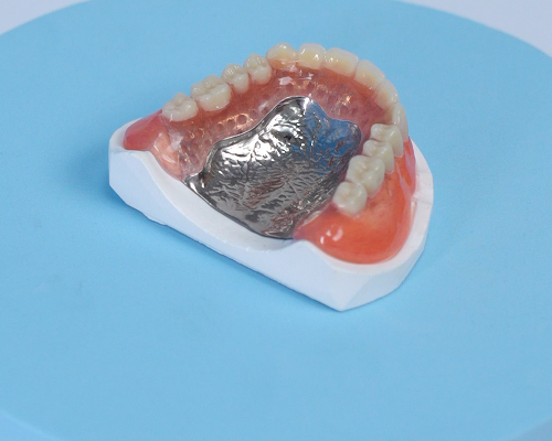 3D激光打印钴铬义齿的特点及优势解析
